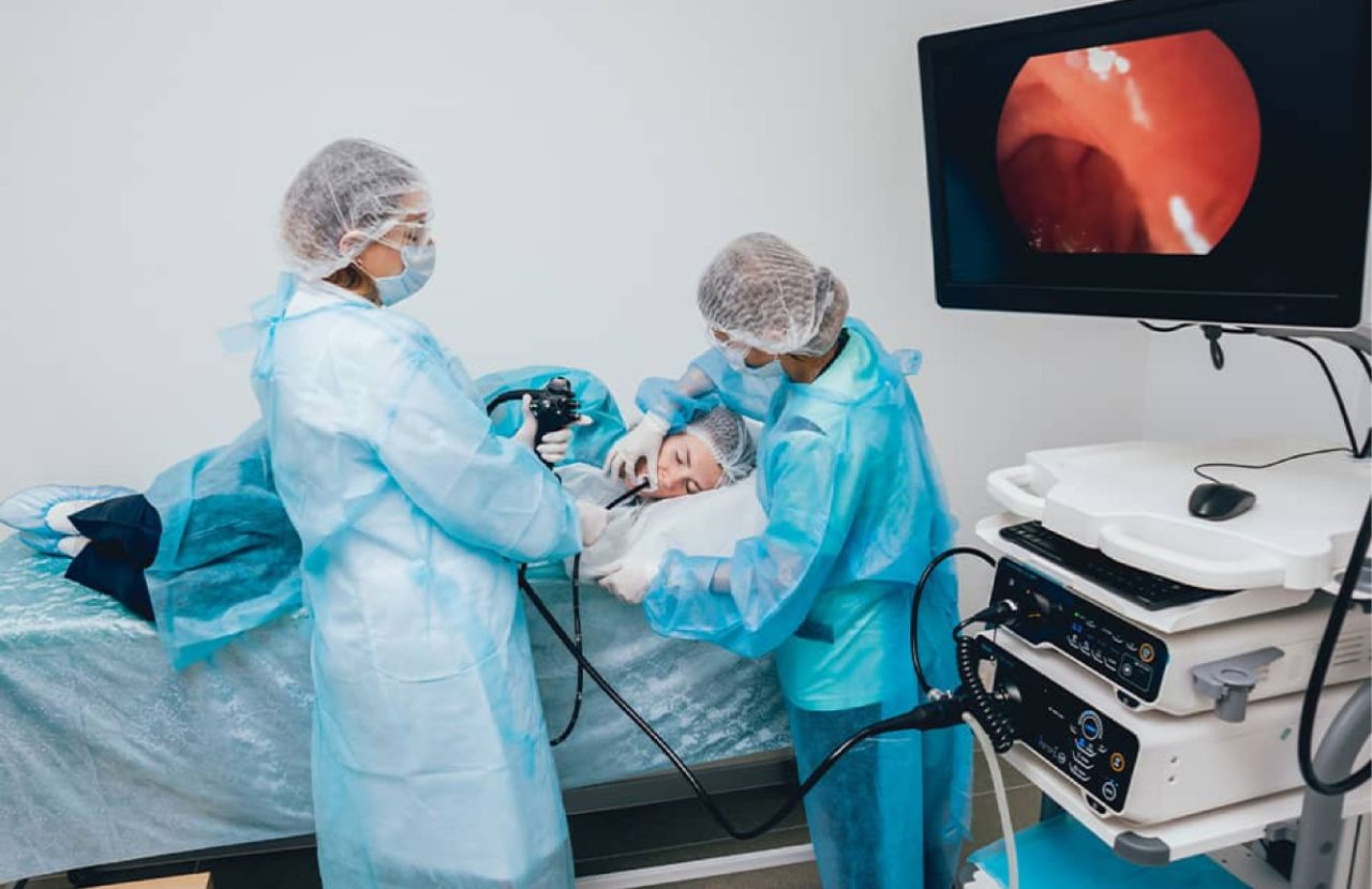 30 Hechos Sobre Endoscopia