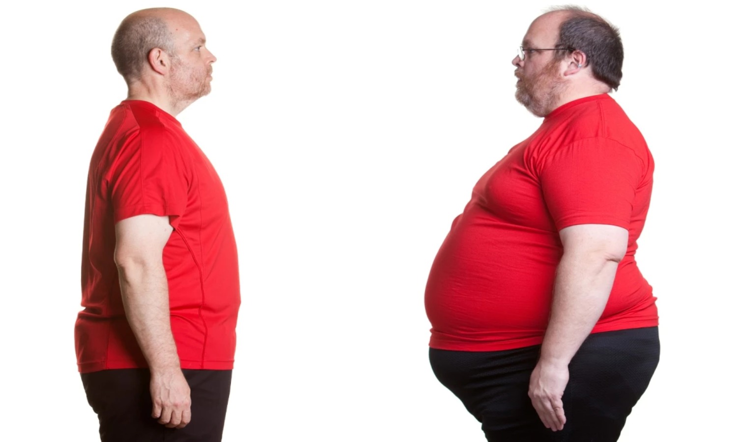 38 Hechos Sobre Obesidad